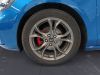 Focus 1.5 ECOBOOST 150 CAst line detail